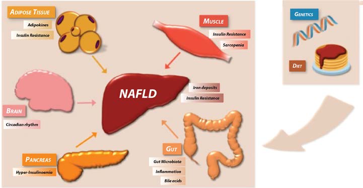 Figure 1. NAFLD is a component of a multisystemic disease Adapted from Int. J. Mol. Sci. 2019, 20, 1948; doi:10.3390/ijms20081948
